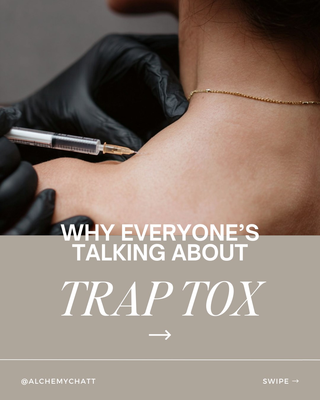 💉 Why is everyone talking about Trap Tox? Let’s break it down ⬇️
👉 Trap Tox = Tox for your trapezius muscles (the ones that run from your neck to your shoulders).
✨ Benefits include:
• A slimmer, more elegant neckline
• Relief from tight, overworked muscles
• Possible easing of tension headaches
⚡ How it works: The injections relax the traps over time, creating a sleeker, elongated neck + shoulders while releasing muscle tension.
🙋‍♀️ It’s for you if…
✔ You’re constantly massaging your shoulders
✔ Your neck feels tight after workouts or sitting at a desk
✔ You want a more defined, graceful neckline

At Alchemy MedSpa & Wellness Center, our expert team delivers Trap Tox treatments that blend both beauty + wellness for real results.
📅 Appointments fill fast — book your complimentary consultation today and discover if Trap Tox is right for you!
🔗 www.alchemymedspachatt.com | 423.654.7630
#AlchemyMedSpa #TrapTox #ChattanoogaMedSpa #ToxTreatment #NeckSlimming #WellnessAndAesthetics