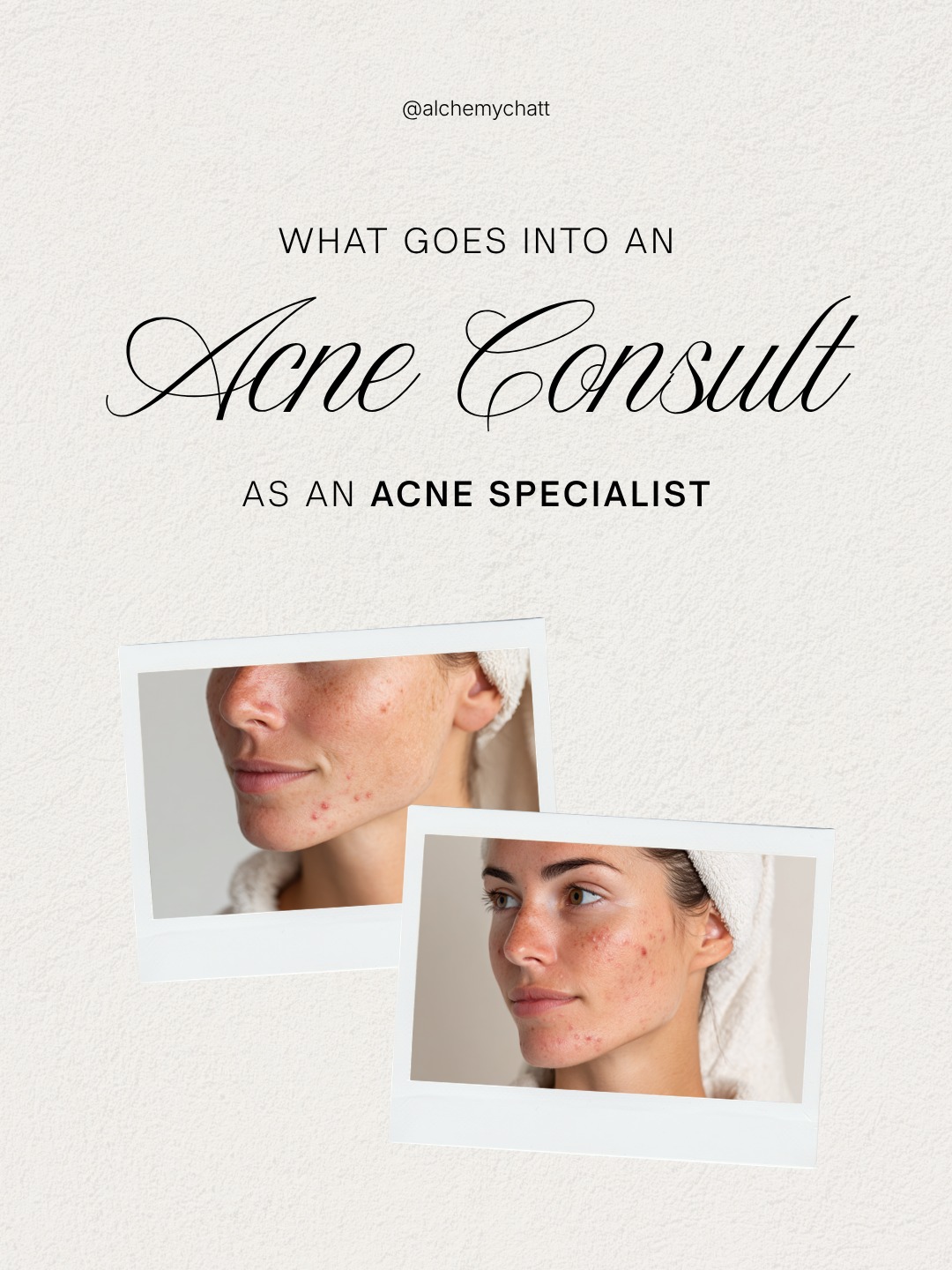 Acne treatment isn’t one-size-fits-all — and it isn’t just about what you put on your skin.  A professional acne consultation looks deeper to understand why breakouts are happening so treatment can be targeted, effective, and sustainable.

During an acne consult, we evaluate:
• type of acne (hormonal, inflammatory, congested, cystic)
• pattern and location of breakouts
• current skincare products and routines
• lifestyle factors like stress, sleep, and diet
• habits that may be affecting your skin barrier
• treatment history and skin goals

Acne can be influenced by multiple factors, which is why personalized treatment plans often lead to better long-term outcomes.

Healthy skin starts with understanding your skin.
Schedule your acne consultation today.
📍 Alchemy MedSpa & Wellness Center
📞 423.654.7630

#AcneSpecialist #AcneTreatment #ChattanoogaMedSpa #HormonalAcne #AdultAcne #SkinCarePlan #HealthySkinJourney #AcneSolutions #MedicalAesthetics #SkinConfidence #CustomizedSkincare #BarrierRepair #AcneHelp #SkinHealth #MedSpaChattanooga