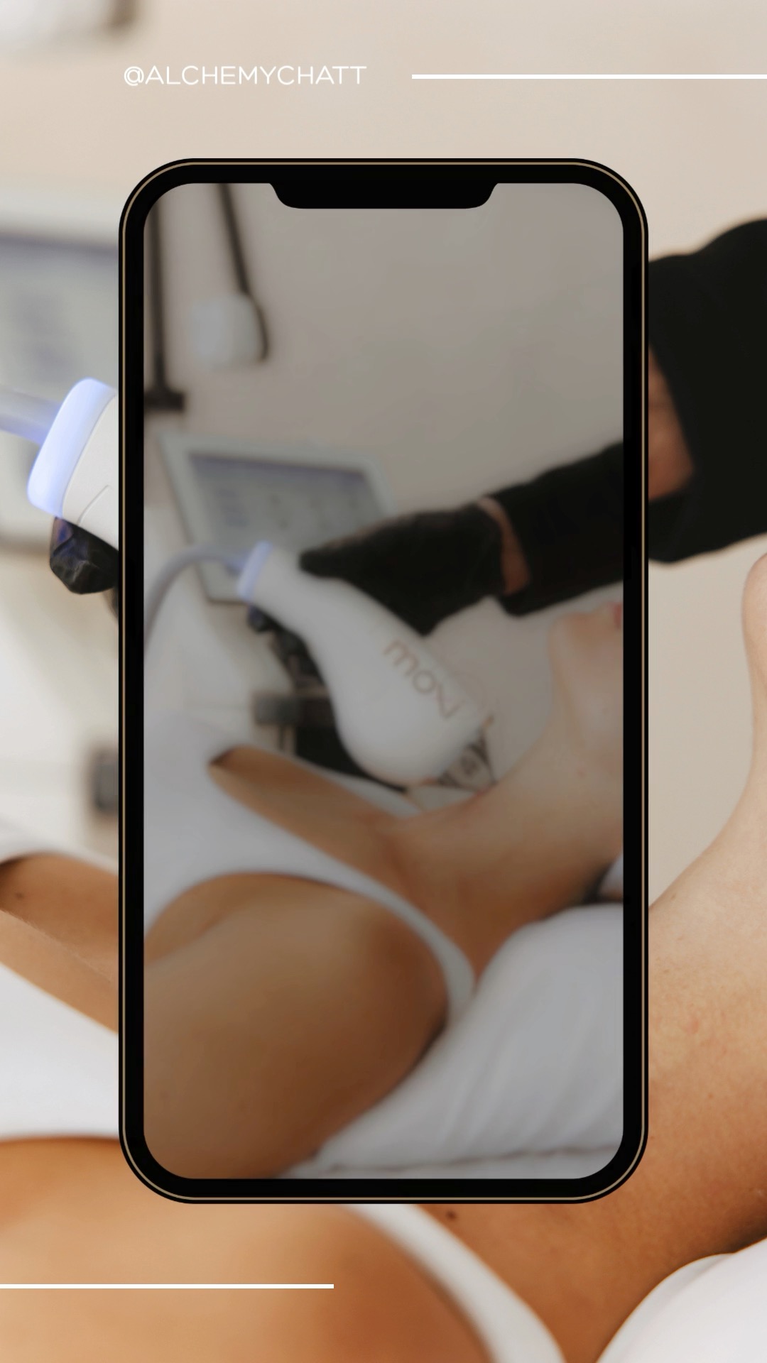 Healthier skin starts below the surface ✨
MOXI laser is one of the most requested treatments for improving overall skin tone, texture, and radiance with minimal downtime.

This gentle fractional laser helps:
✔ improve uneven skin tone
✔ reduce sun damage appearance
✔ smooth skin texture
✔ soften fine lines
✔ stimulate collagen production
✔ restore natural glow

MOXI is ideal for patients wanting noticeable skin improvement without aggressive treatment or extended recovery time.
Great for maintaining healthy skin year-round and preventing visible signs of aging.

📍 Alchemy MedSpa & Wellness | Chattanooga
📆 Schedule a consultation to see if MOXI is right for your skin goals

#MOXILaser #LaserSkinTreatment #SkinRejuvenation #ChattanoogaMedSpa #CollagenBoosting #SunDamageTreatment #SkinTexture #HealthySkin #AestheticTreatments #MedicalGradeSkincare #SkinConfidence #GlowingSkin #PreventativeSkincare #LaserFacial #SkinCareExperts