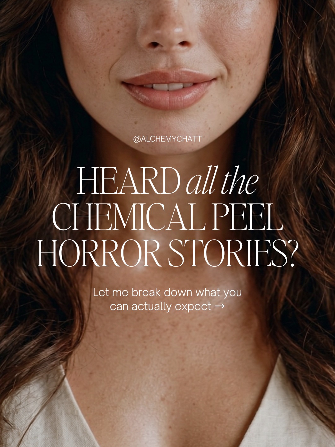Thinking about a chemical peel in Chattanooga but not sure what to expect? ✨
Let’s make it simple—and stress-free.
At Alchemy MedSpa + Wellness, every peel is customized to your skin type and goals so you get real results safely.

✨ What to expect:
• A personalized skin assessment
• A quick 30–45 minute treatment
• Mild tingling (completely normal!)
• Peeling starts around day 3
• Fresh, glowing skin within 1–2 weeks

✨ What it treats:
✔️ Acne + breakouts
✔️ Fine lines + wrinkles
✔️ Sun damage + dark spots
✔️ Uneven texture + dull skin

You just found your place.
✨ Your skin reset starts here.
📍 Alchemy MedSpa + Wellness | Chattanooga, TN
📅 Book online anytime or call our office to schedule your consultation - www.alchemymedspachatt.com

#ChemicalPeelChattanooga #MedSpaNearMe #SkinCareChattanooga #GlowingSkin #SkinRejuvenation #AcneTreatment #AntiAgingSkin #ChattanoogaTN #AlchemyMedSpa