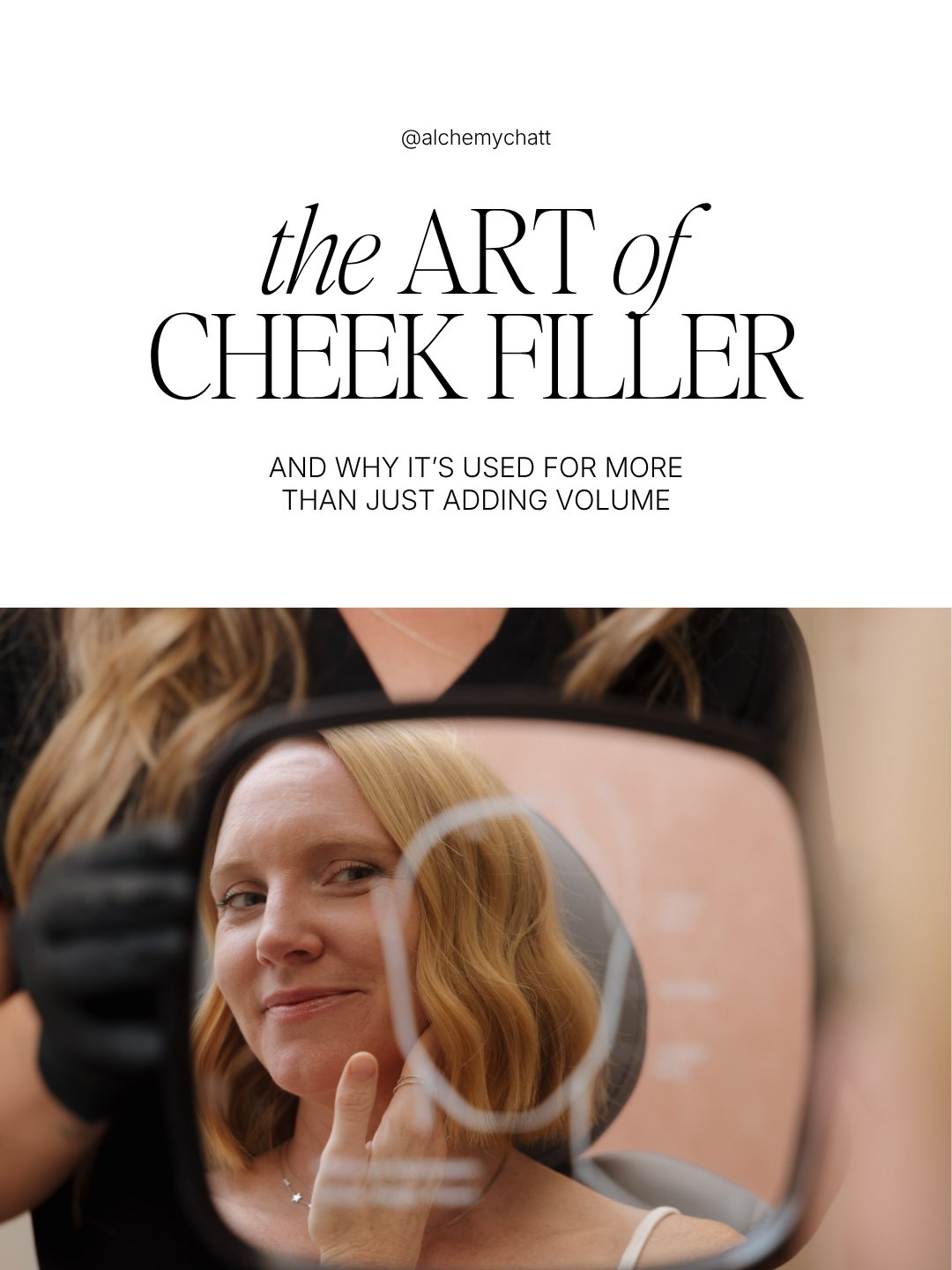 When many people hear the word filler, they think of dramatically overfilled cheeks.
The truth? Beautiful cheek filler isn't about making your face look bigger—it's about restoring what time naturally changes.
As we age, we gradually lose collagen, fat, and bone support through the mid-face. This can lead to:
• A tired appearance
• Flattened cheeks
• More noticeable smile lines
• Less facial definition
• A subtle loss of lift
Strategically placed cheek filler can help restore facial support while maintaining a natural, refreshed appearance—not a "done" look. At Alchemy MedSpa & Wellness Center, our philosophy is simple: Enhance—not change.
Every treatment is customized to your facial anatomy, proportions, and aesthetic goals because the most beautiful results are the ones that still look like you.
If you've ever wondered whether filler could help you look more rested, refreshed, or balanced, we'd love to answer your questions.