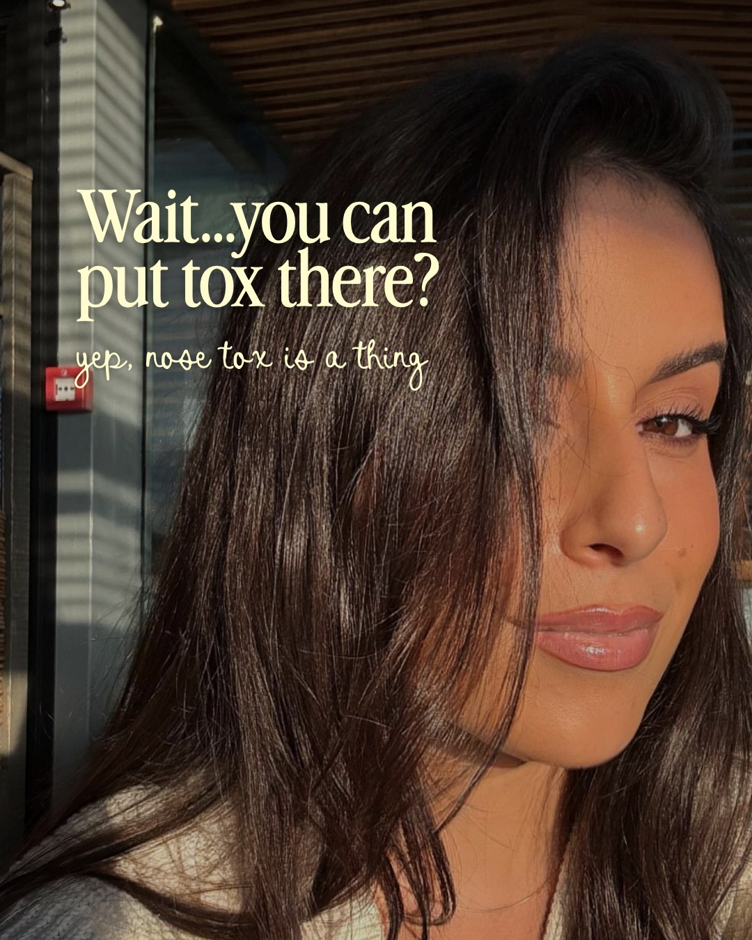 Wait… you can put Botox in your nose?

Yep. Nose tox is a thing. And if you've never heard of it, you're definitely not alone.

“Nose tox” is a subtle treatment that uses small amounts of neuromodulator in specific muscles around the nose. Depending on your anatomy and your goals, it may be used to address concerns such as:

✨ A nasal tip that pulls downward when you smile
✨ “Bunny lines” along the sides of the nose
✨ Certain types of nostril flaring

And here's the important part: it's not about changing the structure of your nose.

It's about making subtle adjustments to muscle movement for a more refined result.

Not everyone is a candidate—and that's exactly why a consultation matters. Your anatomy, facial movement and desired outcome should all be considered before treatment.

💉 Curious about  nose tox? Book a consultation with our injectors today. 

#NoseTox  #NasalTipBotox #BunnyLines #NostrilFlaring  #MedSpaChattTN #Neuromodulator #FacialAesthetics #AestheticMedicine #AlchemyMedSpa #AlchemyWellness #Injectables  #AestheticsChattTN
