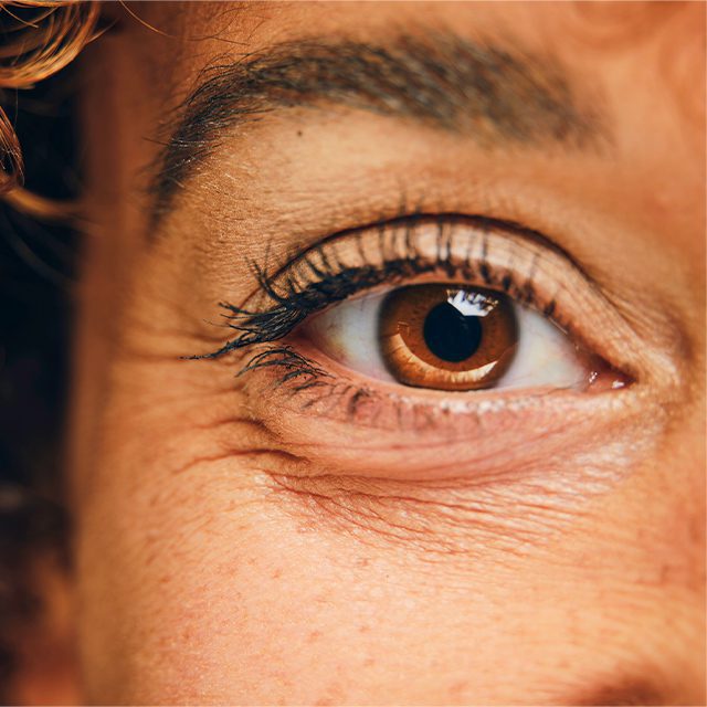 woman with fine lines around her eye