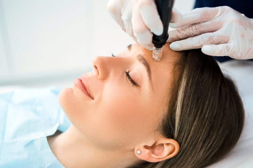 Calm woman having a micro needling procedure.