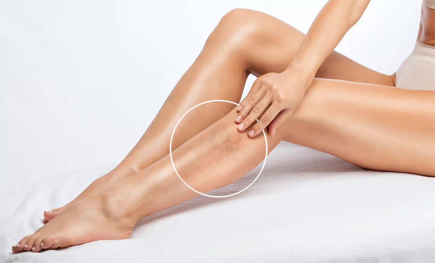 close up of a woman looking at her spider veins
