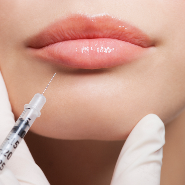 Lip Filler