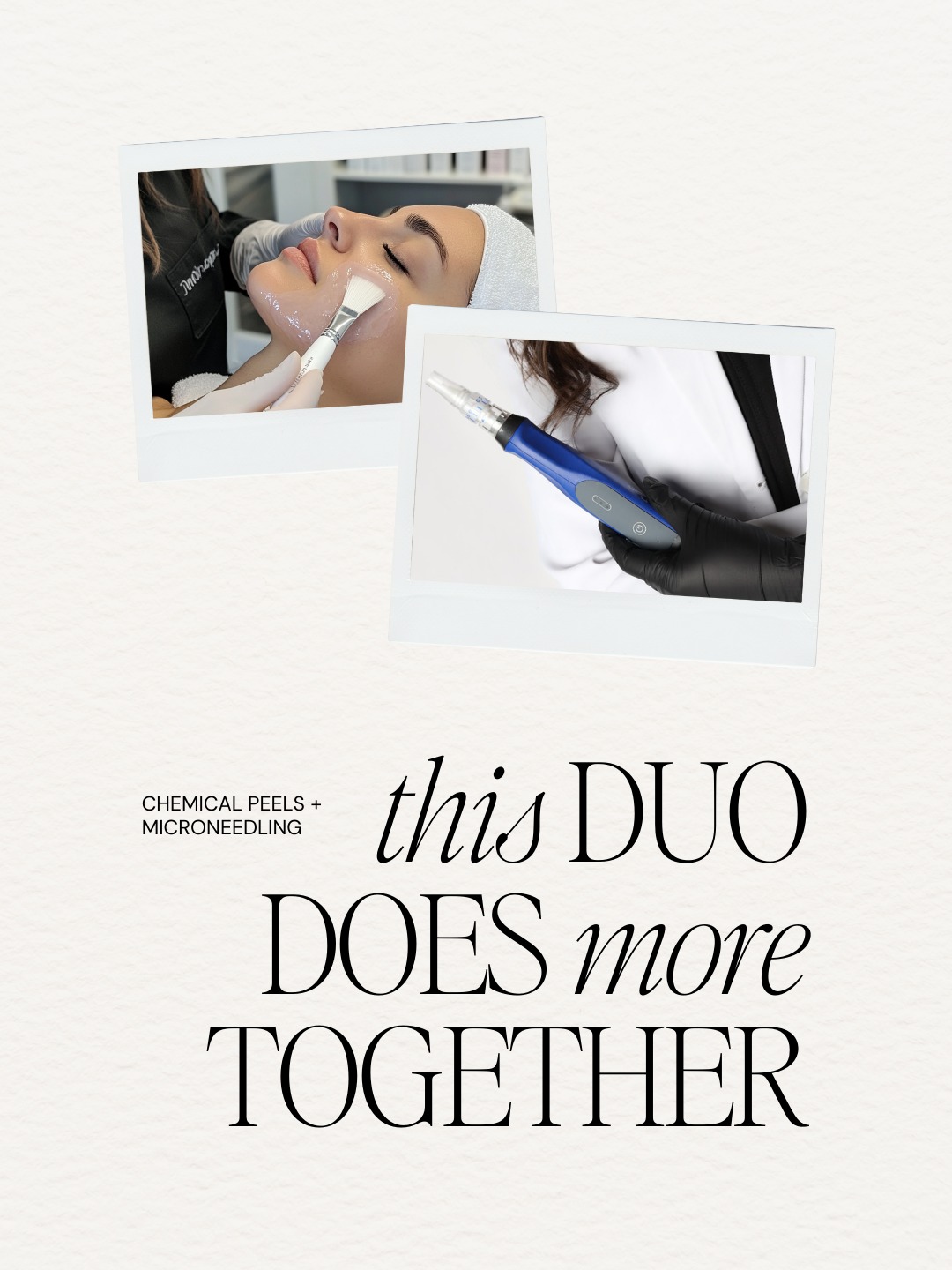 Peel first. Needle after.
This combo is one of our GO-TO skin strategies for a reason, and personally one of my FAVS. ❤️
Peel first to clear the dull stuff.
Microneedle after to stimulate collagen and let your skin actually absorb the good things.
When done in the right order, you get smoother texture, brighter tone, softened fine lines, and results that actually last.
Book today using the link in the bio | or call to schedule at 423.654.7630
Have you tried this combo before? Let us know in the comments! 💬
#chattmicroneedling #chattchemicalpeel