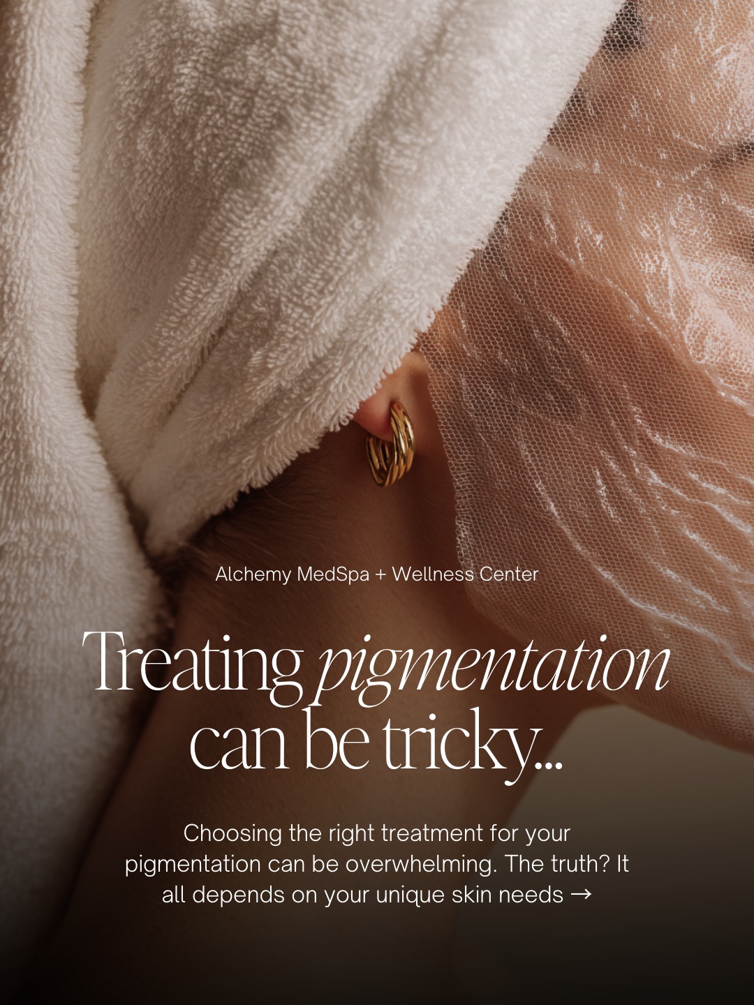 Let’s talk pigment, because it’s never as simple as “just use this one thing.”
Some pigment responds beautifully to skincare, some needs peels, and some needs laser support.
The trick is knowing which your skin actually needs.
Skincare can do a lot for mild or early pigment.
Peels help refresh the surface and speed things up.
Lasers are best for stubborn, targeted discoloration when other treatments fall short.
The secret? Matching the treatment to your pigment and skin type.
Use the link in the bio to schedule your appointment or call today at 423.654.7630 to book a pigment consult!
#chattpigment