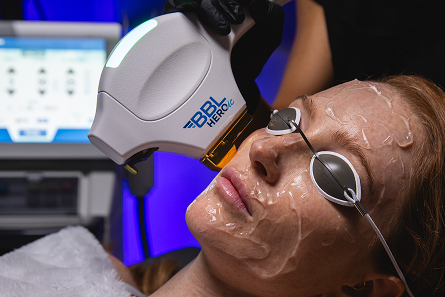 Woman receiving laser treatment