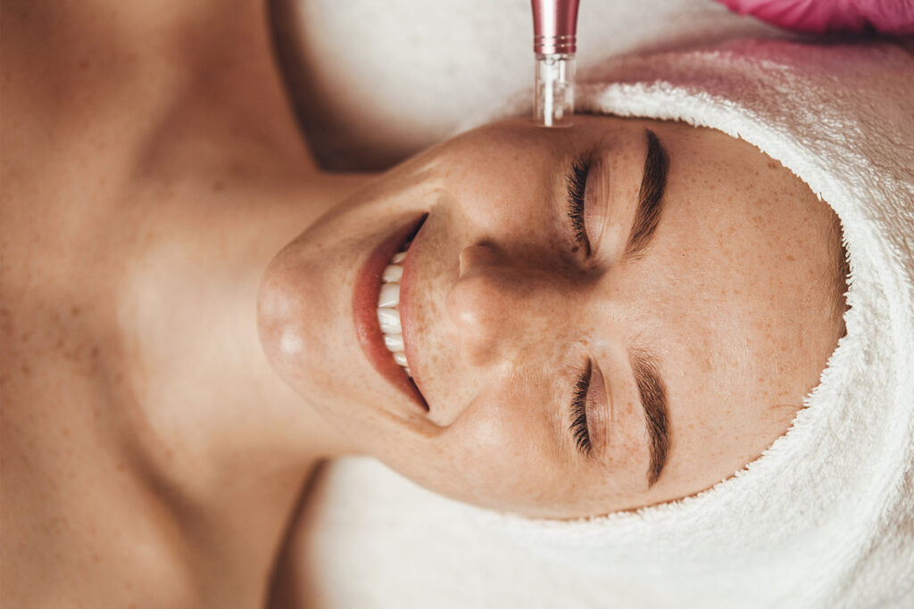 Woman receiving microneedling treatment
